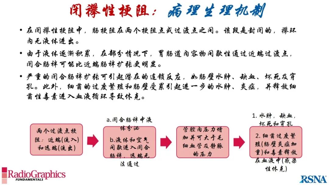 影像PPT - 【PPT】胃肠道扩张:为什么会发生以及如何发生的病理生理机制？——简易的影像学分类-83