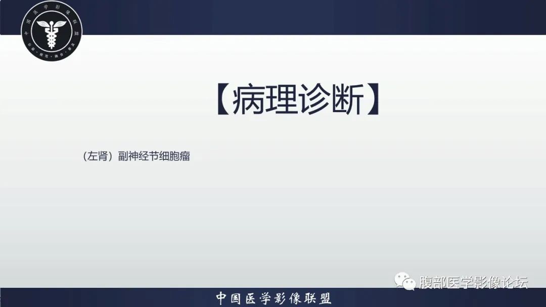 影像PPT - 【病例】肾脏副神经节细胞瘤1例影像分析-21