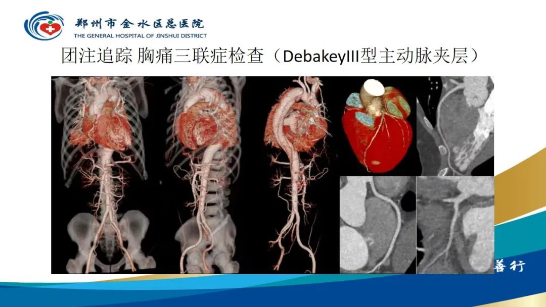 影像PPT - 【PPT】高端螺旋CT的临床应用-8