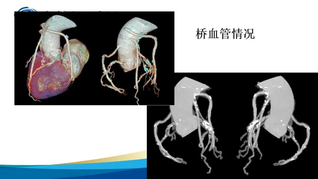 影像PPT - 【PPT】高端螺旋CT的临床应用-12