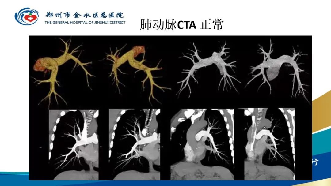 影像PPT - 【PPT】高端螺旋CT的临床应用-15