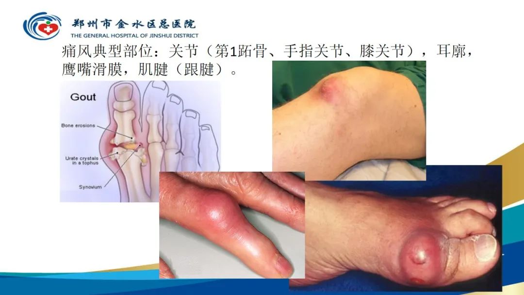 影像PPT - 【PPT】高端螺旋CT的临床应用-19