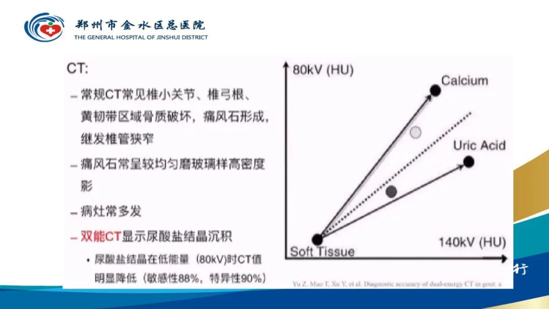 影像PPT - 【PPT】高端螺旋CT的临床应用-21