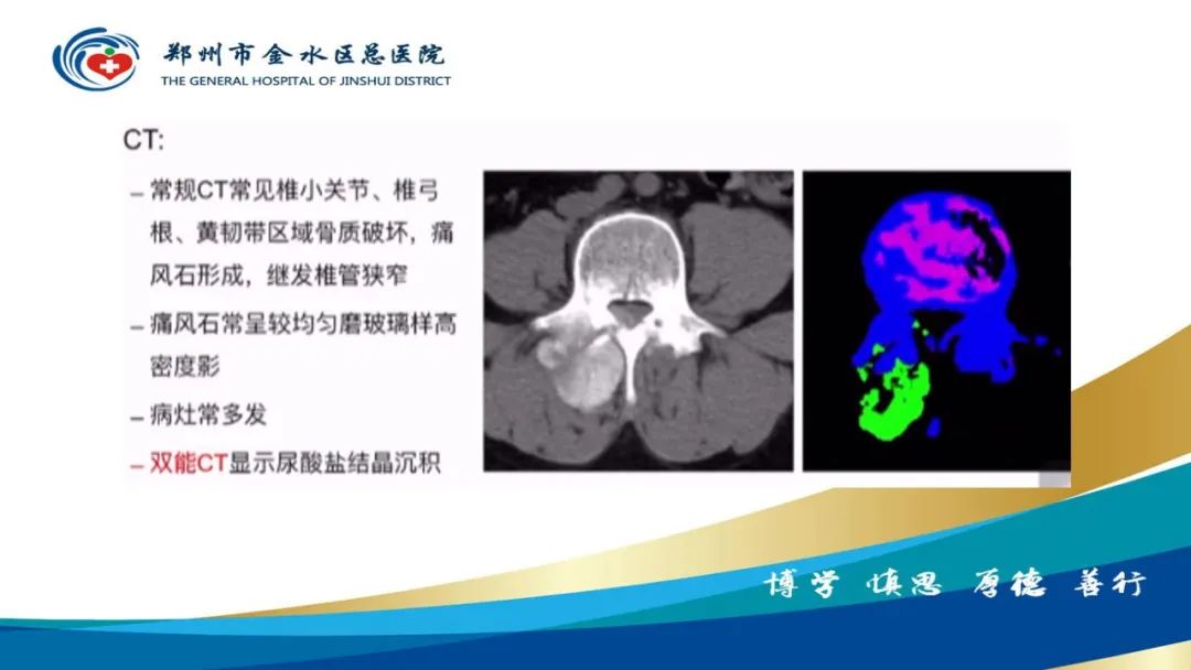 影像PPT - 【PPT】高端螺旋CT的临床应用-23