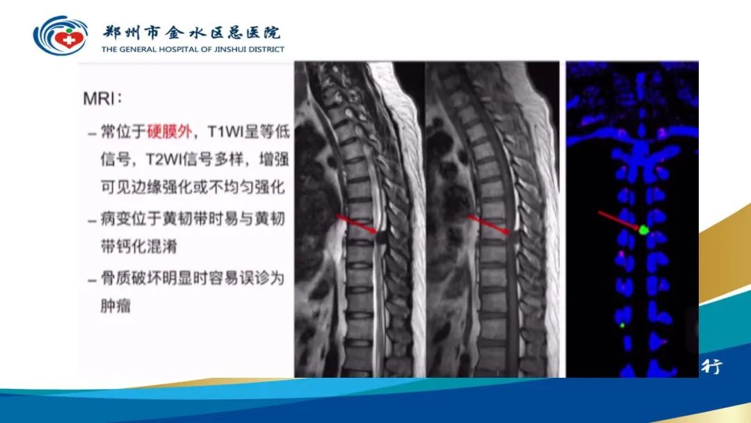 影像PPT - 【PPT】高端螺旋CT的临床应用-26