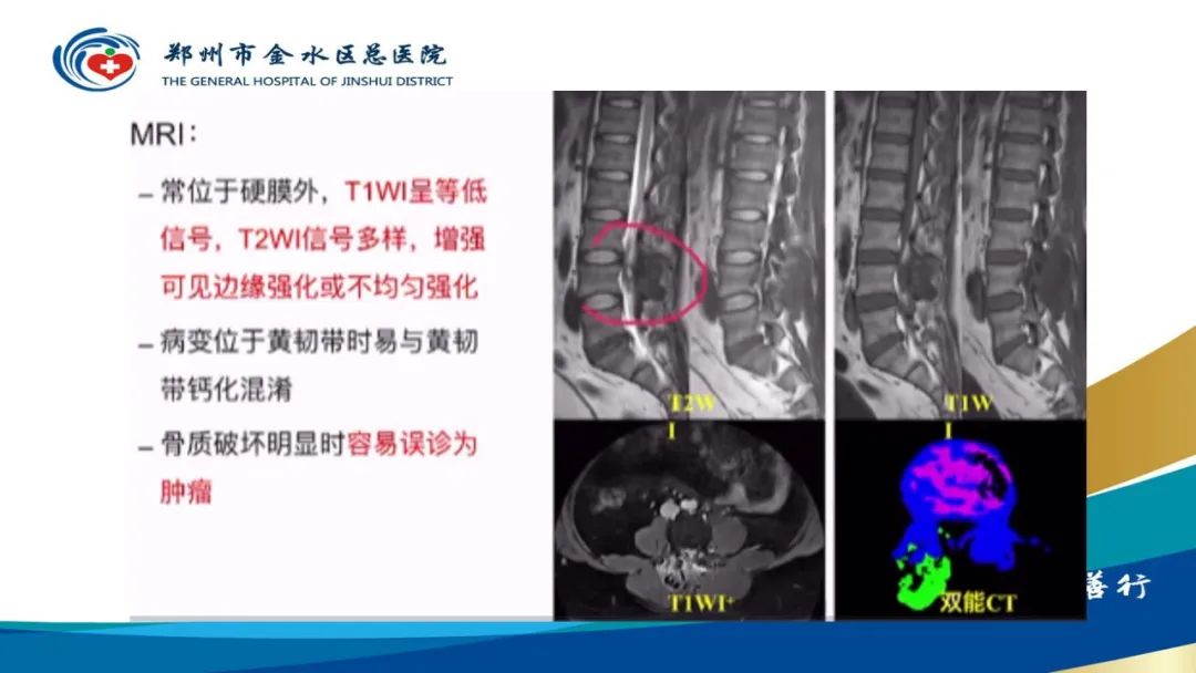 影像PPT - 【PPT】高端螺旋CT的临床应用-27