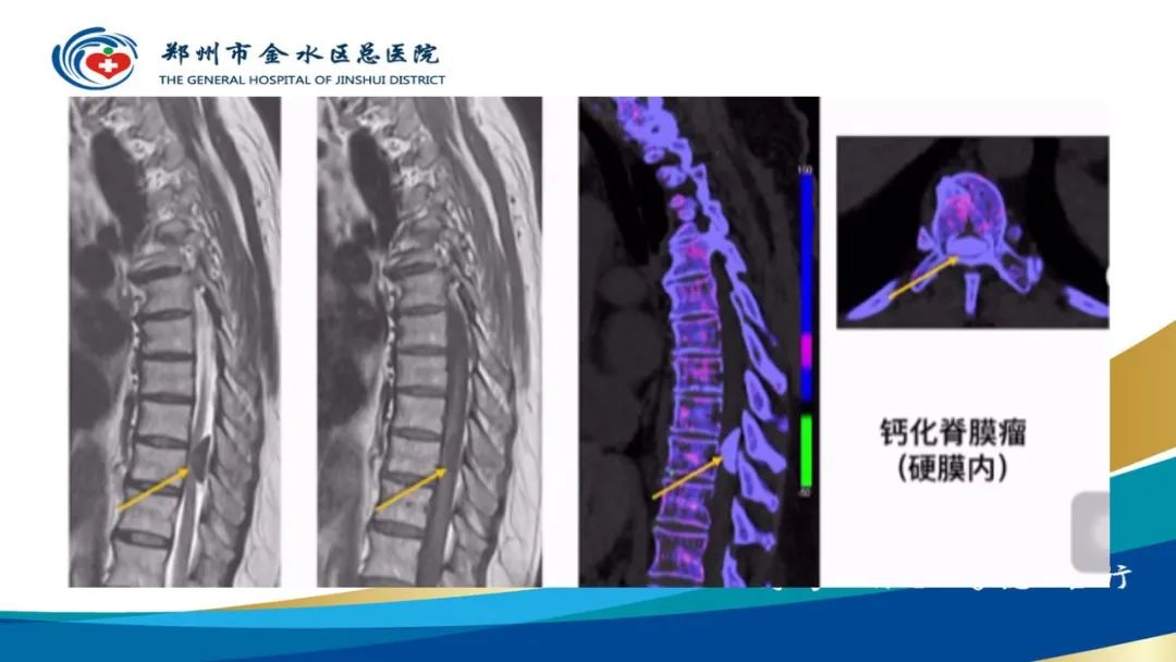 影像PPT - 【PPT】高端螺旋CT的临床应用-28