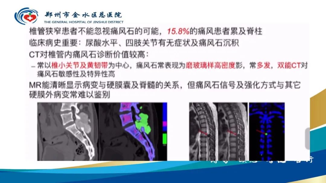 影像PPT - 【PPT】高端螺旋CT的临床应用-29