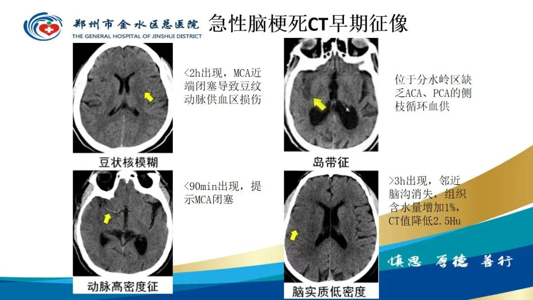 影像PPT - 【PPT】高端螺旋CT的临床应用-31