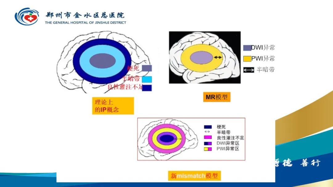 影像PPT - 【PPT】高端螺旋CT的临床应用-35