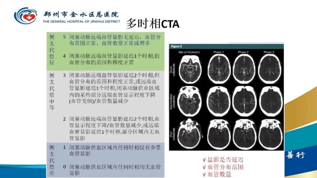 影像PPT - 【PPT】高端螺旋CT的临床应用-36