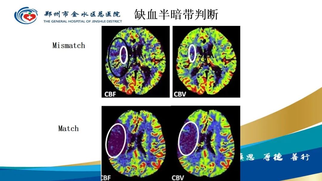 影像PPT - 【PPT】高端螺旋CT的临床应用-40