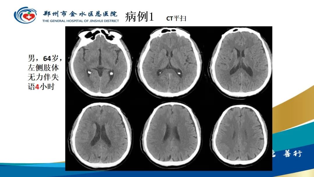 影像PPT - 【PPT】高端螺旋CT的临床应用-41