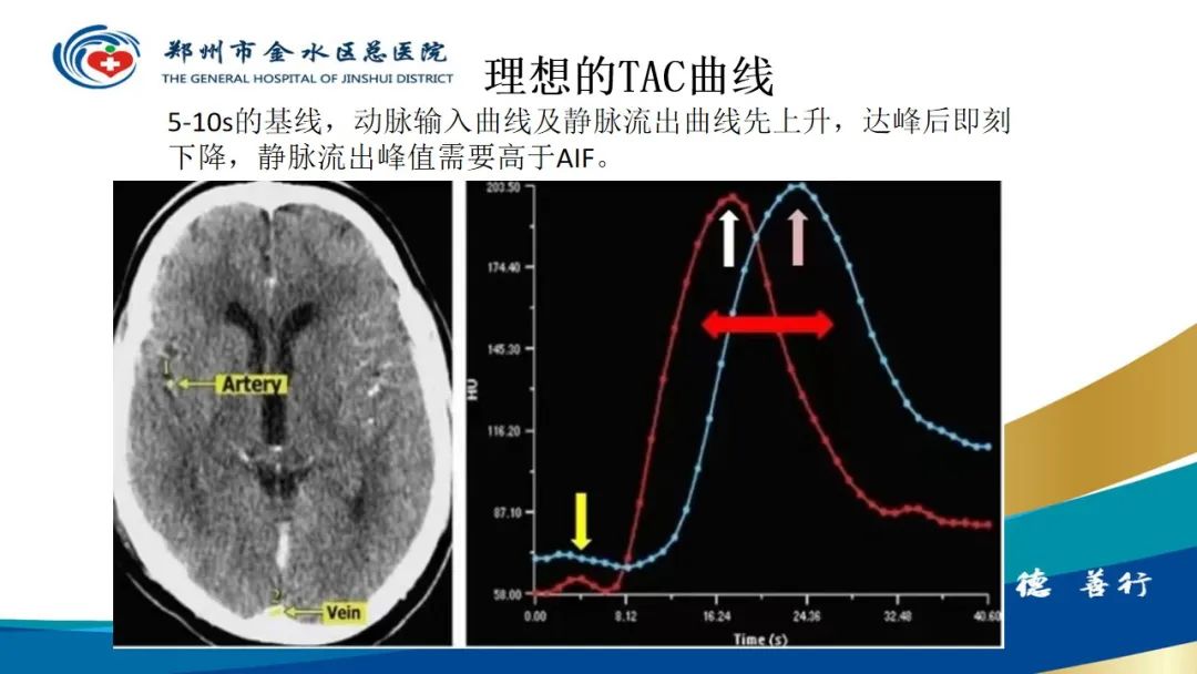 影像PPT - 【PPT】高端螺旋CT的临床应用-38