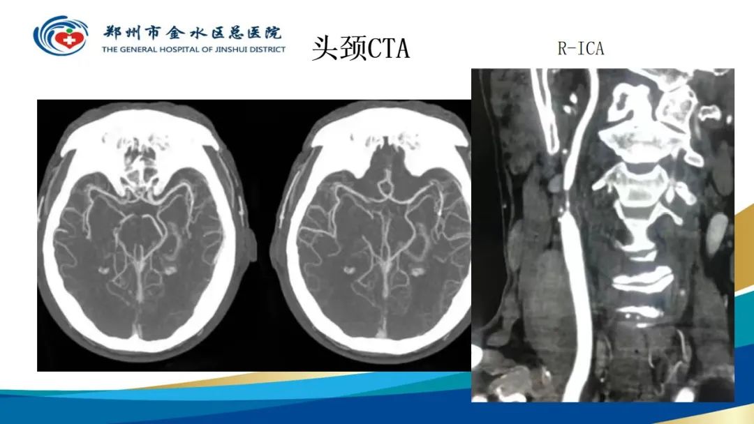 影像PPT - 【PPT】高端螺旋CT的临床应用-43