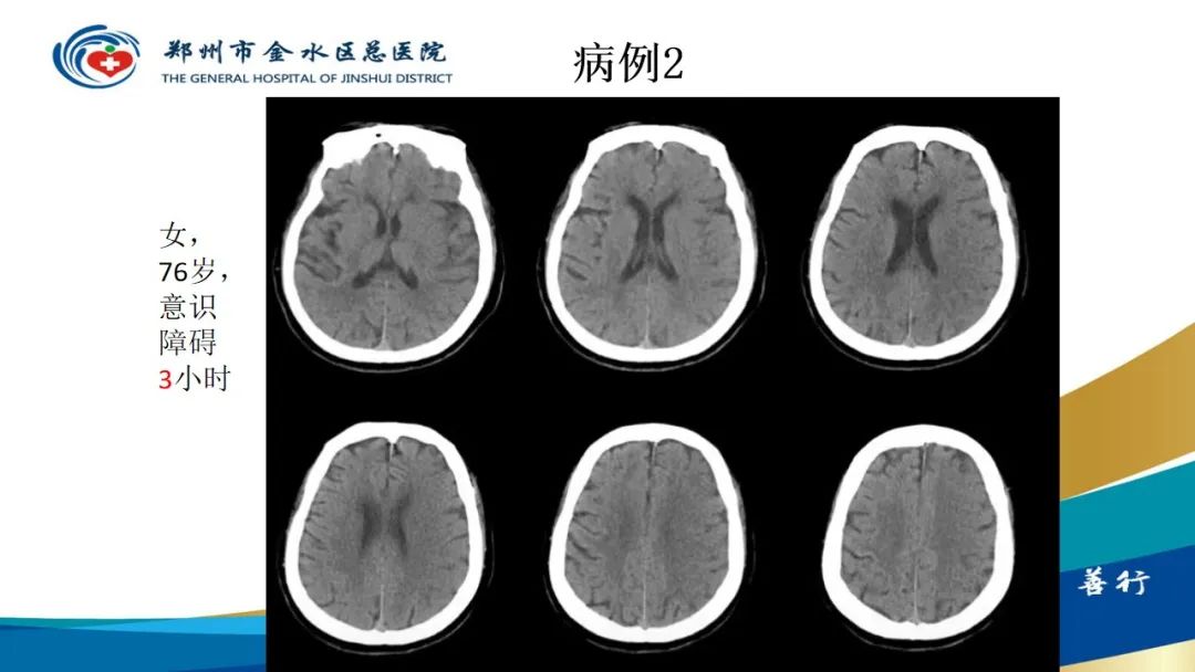 影像PPT - 【PPT】高端螺旋CT的临床应用-45