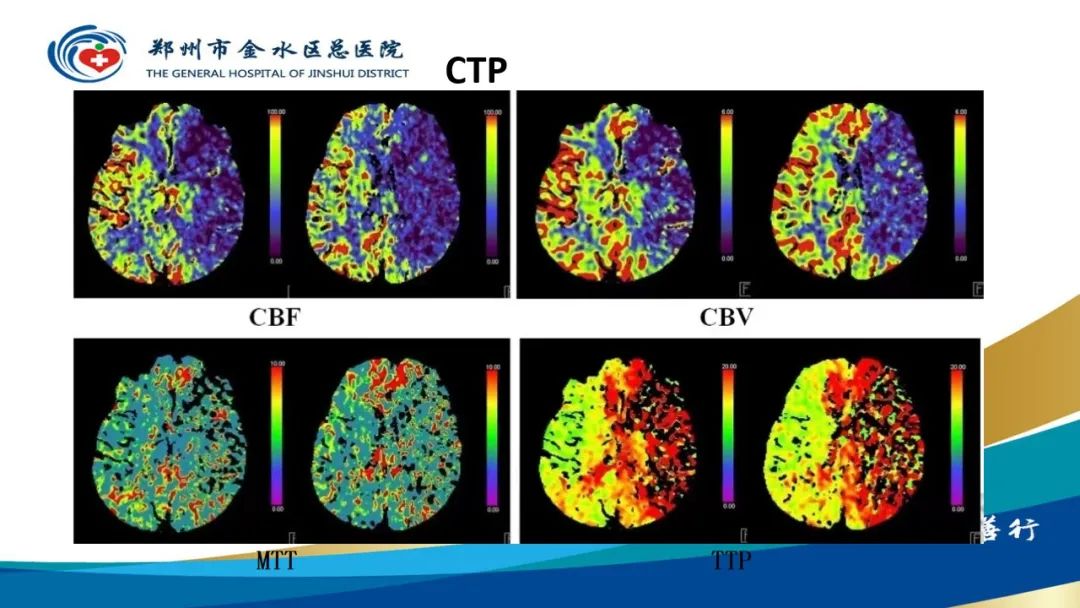影像PPT - 【PPT】高端螺旋CT的临床应用-46