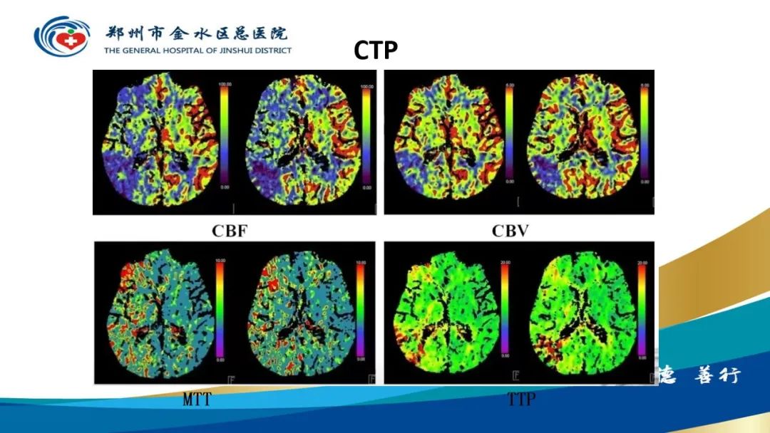 影像PPT - 【PPT】高端螺旋CT的临床应用-42