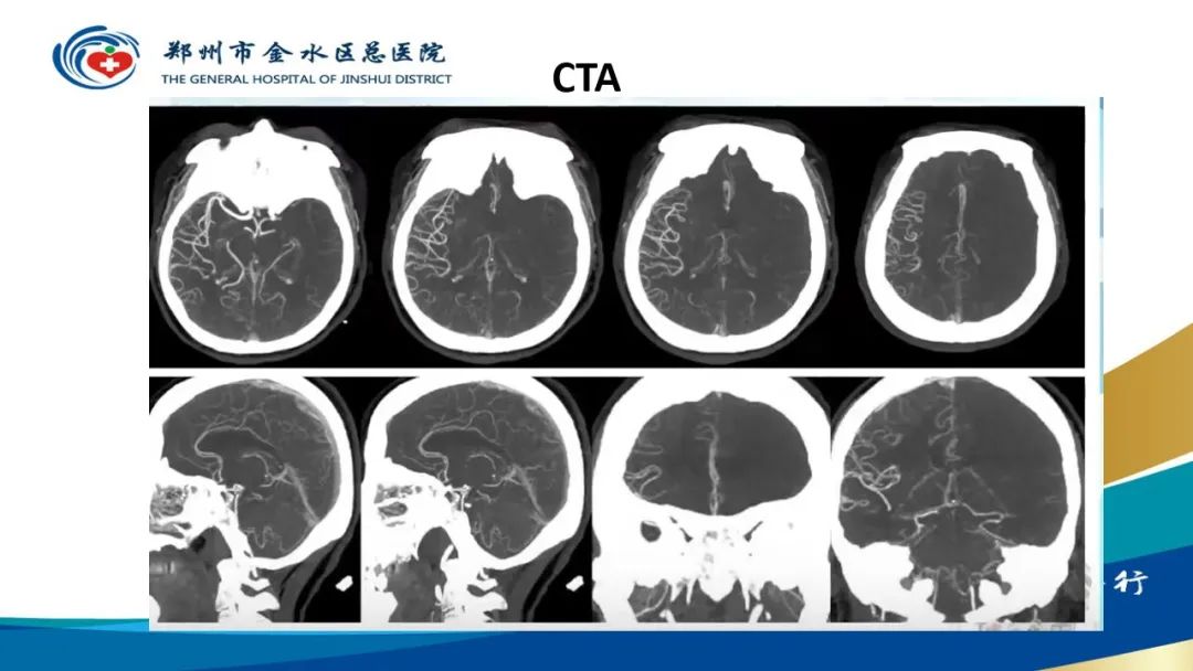影像PPT - 【PPT】高端螺旋CT的临床应用-47