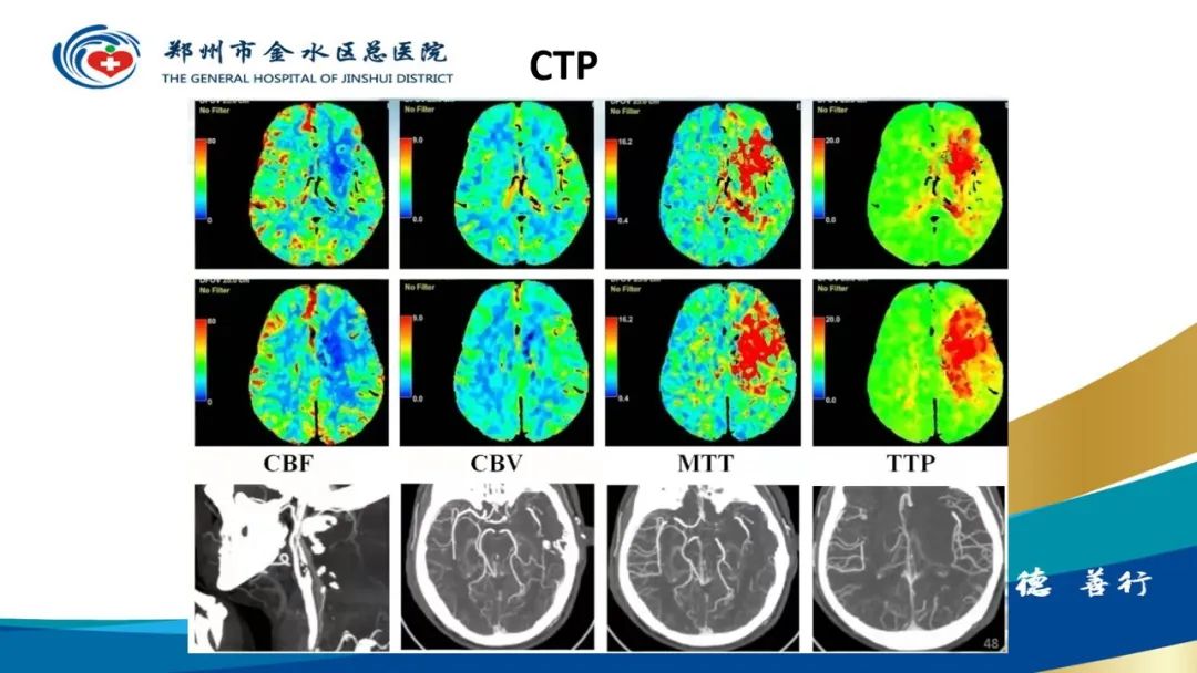 影像PPT - 【PPT】高端螺旋CT的临床应用-49