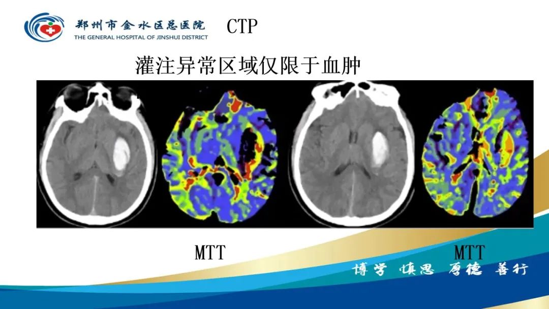影像PPT - 【PPT】高端螺旋CT的临床应用-55