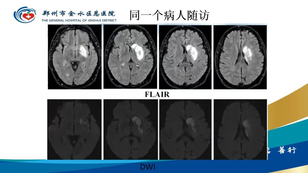 影像PPT - 【PPT】高端螺旋CT的临床应用-51