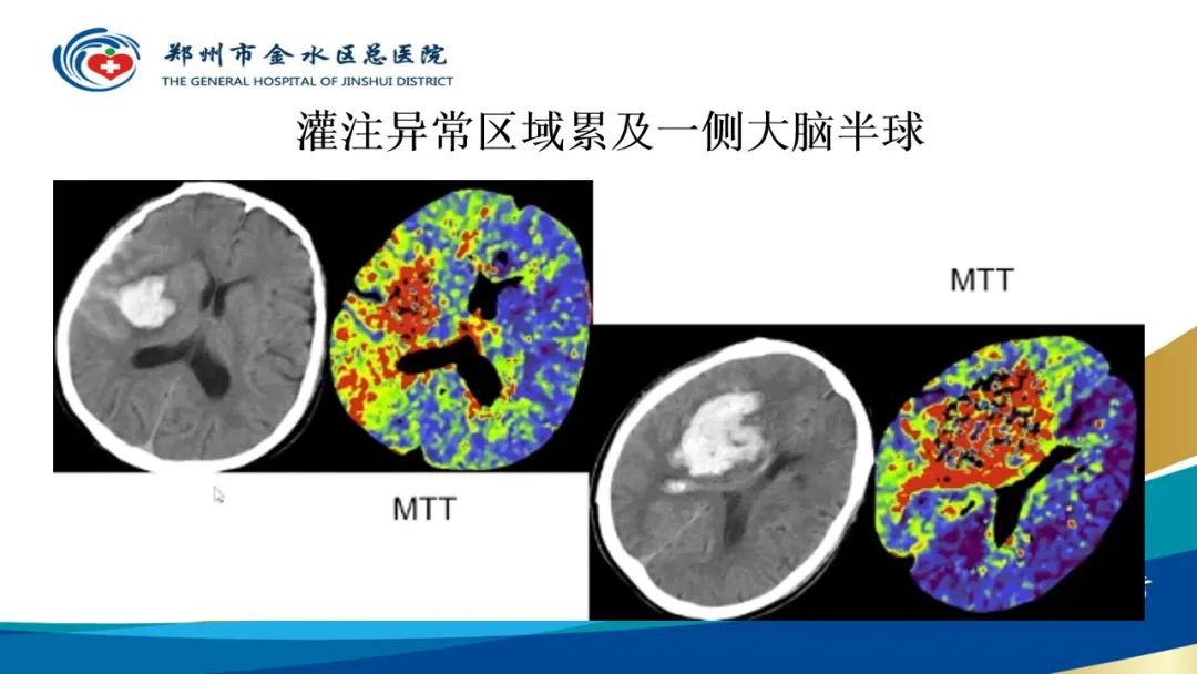 影像PPT - 【PPT】高端螺旋CT的临床应用-57