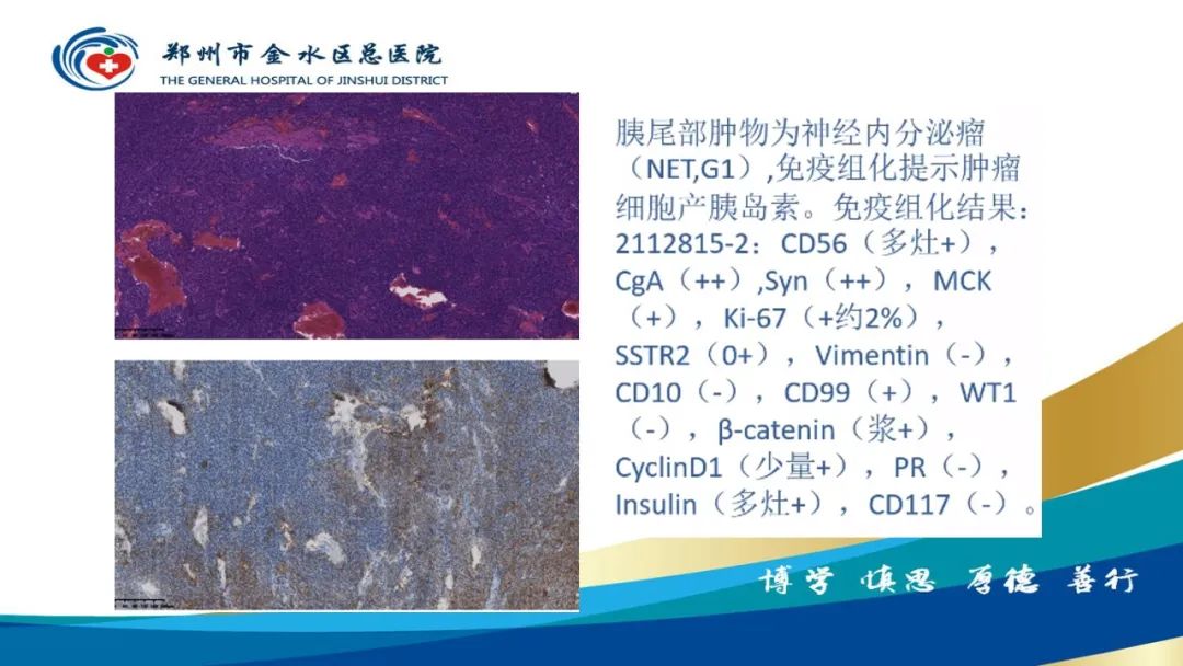 影像PPT - 【PPT】高端螺旋CT的临床应用-62