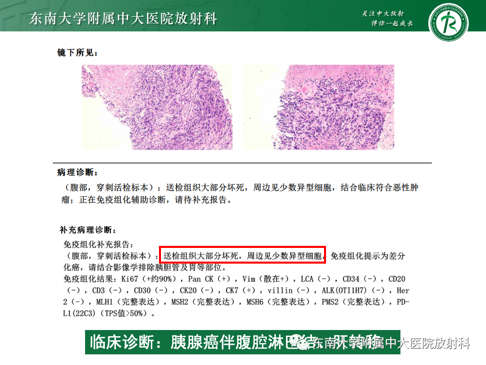 影像PPT - 【PPT】腹部多发淋巴结肿大影像诊断与鉴别-7