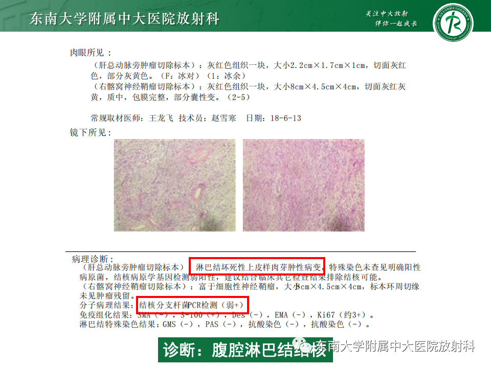 影像PPT - 【PPT】腹部多发淋巴结肿大影像诊断与鉴别-10