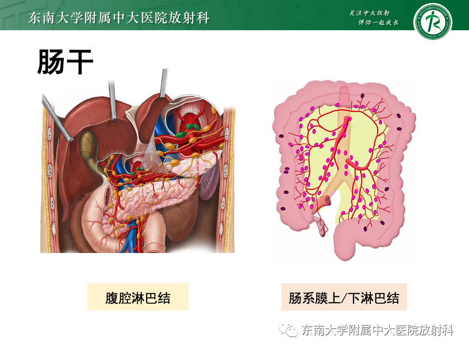 影像PPT - 【PPT】腹部多发淋巴结肿大影像诊断与鉴别-17