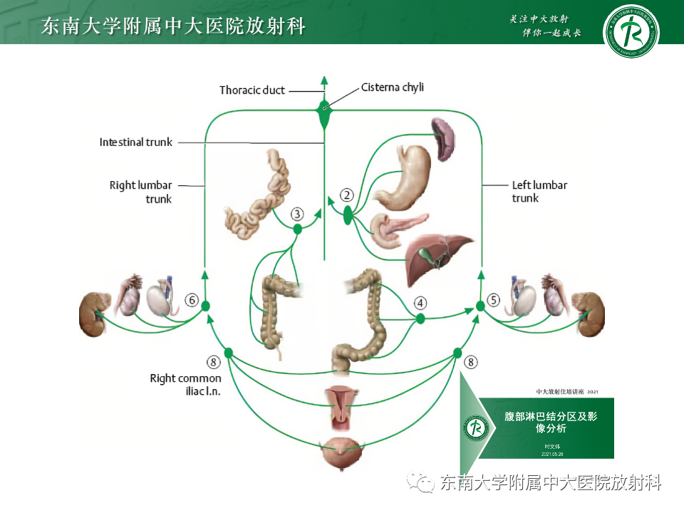 影像PPT - 【PPT】腹部多发淋巴结肿大影像诊断与鉴别-20