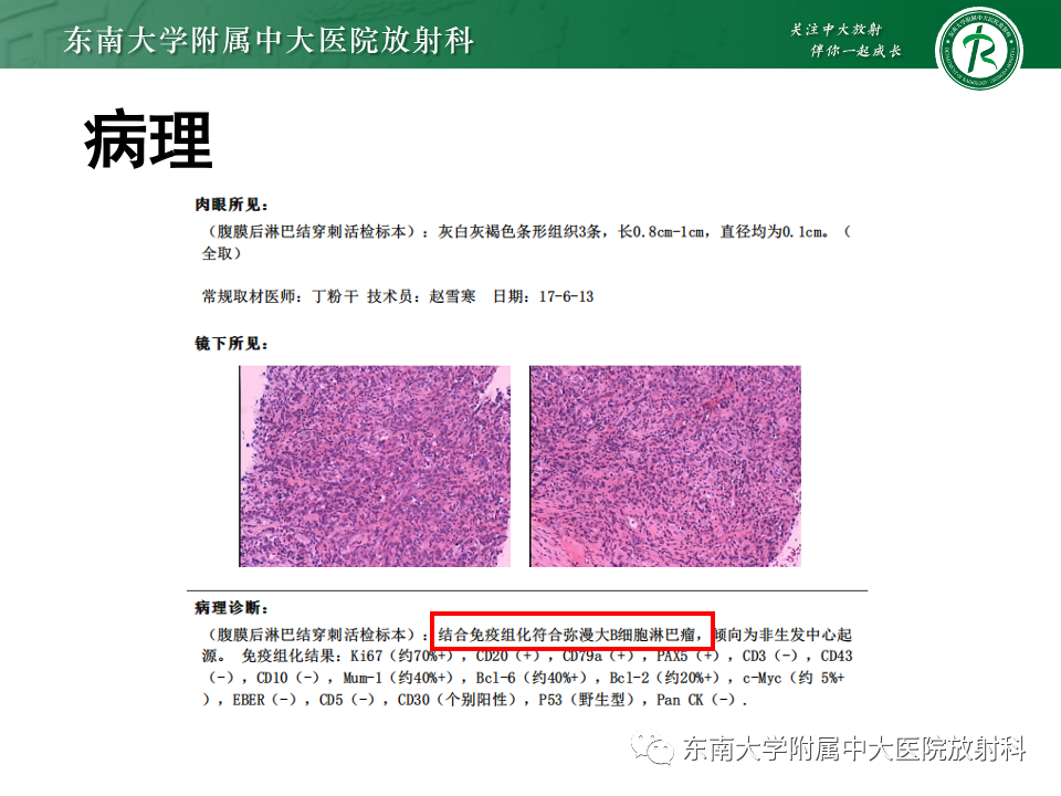影像PPT - 【PPT】腹部多发淋巴结肿大影像诊断与鉴别-31