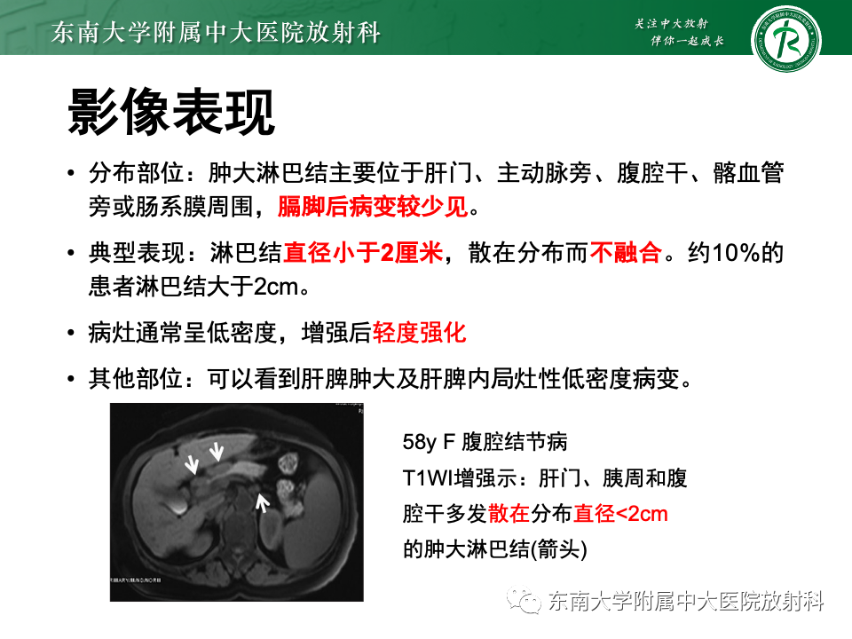 影像PPT - 【PPT】腹部多发淋巴结肿大影像诊断与鉴别-46