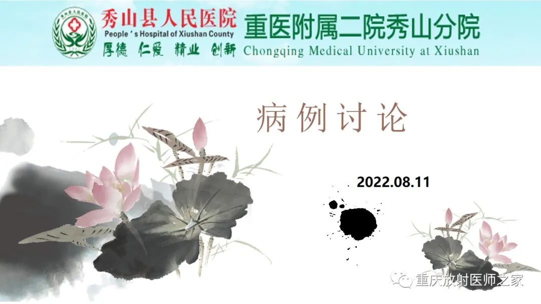 影像PPT - 【病例】胃肠道淋巴瘤1例CT影像-1