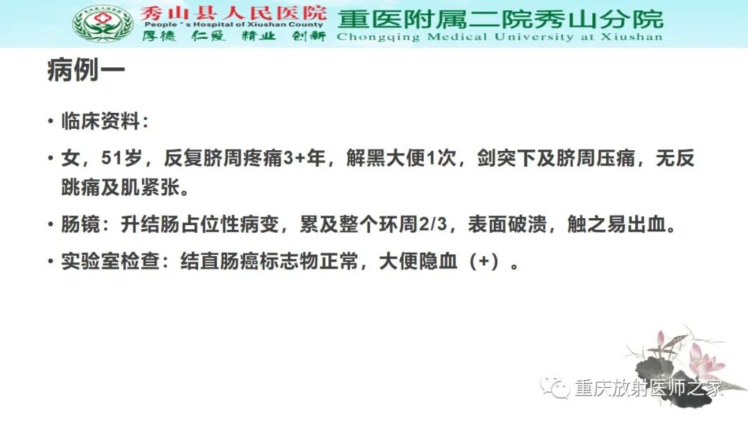 影像PPT - 【病例】胃肠道淋巴瘤1例CT影像-2
