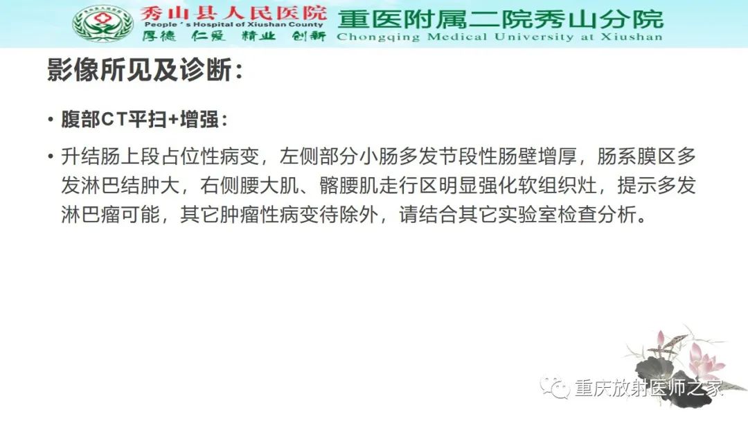 影像PPT - 【病例】胃肠道淋巴瘤1例CT影像-6