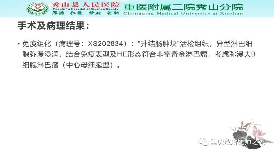 影像PPT - 【病例】胃肠道淋巴瘤1例CT影像-7