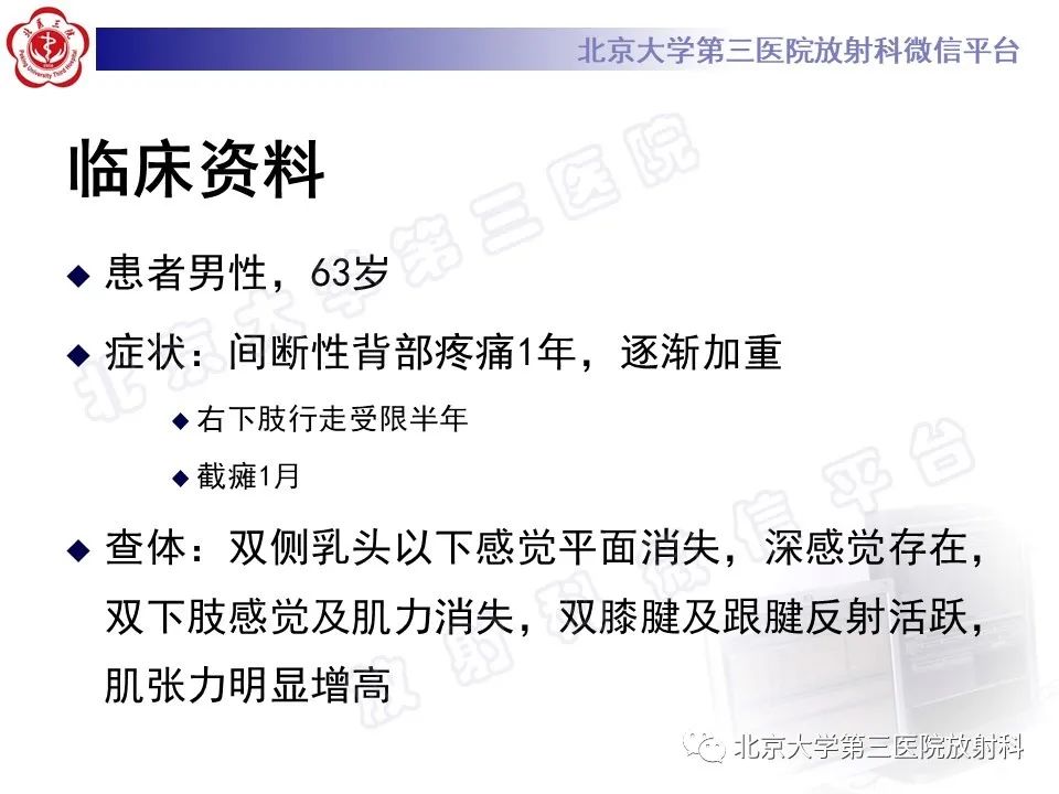 影像PPT - 【PPT】脊柱软骨肉瘤-2