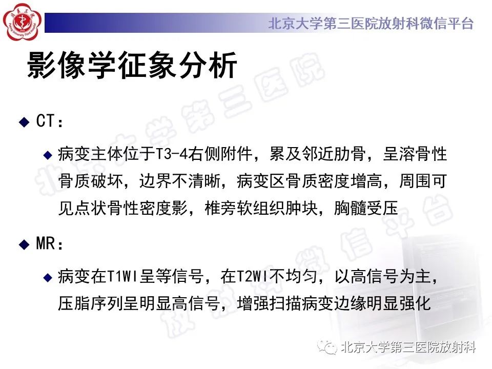 影像PPT - 【PPT】脊柱软骨肉瘤-11