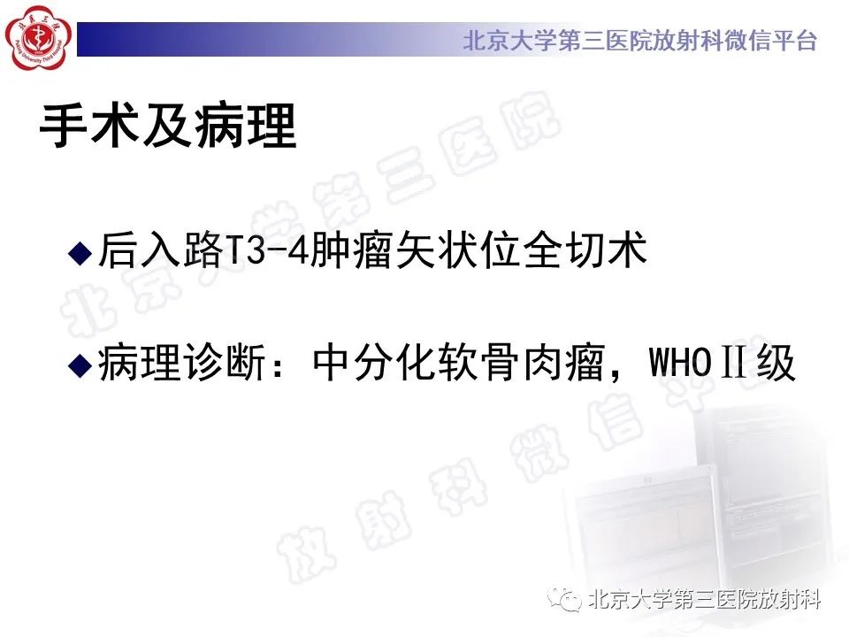 影像PPT - 【PPT】脊柱软骨肉瘤-14