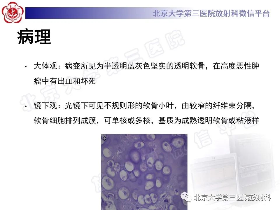 影像PPT - 【PPT】脊柱软骨肉瘤-18