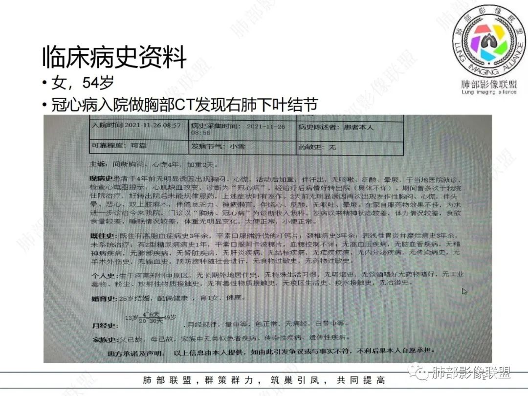 影像PPT - 【病例】发现钙化一定是良性肿瘤吗?-2 影像PPT - 【病例】发现钙化一定是良性肿瘤吗?-2