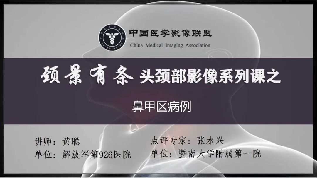 影像PPT - 【病例】鼻腔神经鞘瘤1例CT及MR影像解析-1