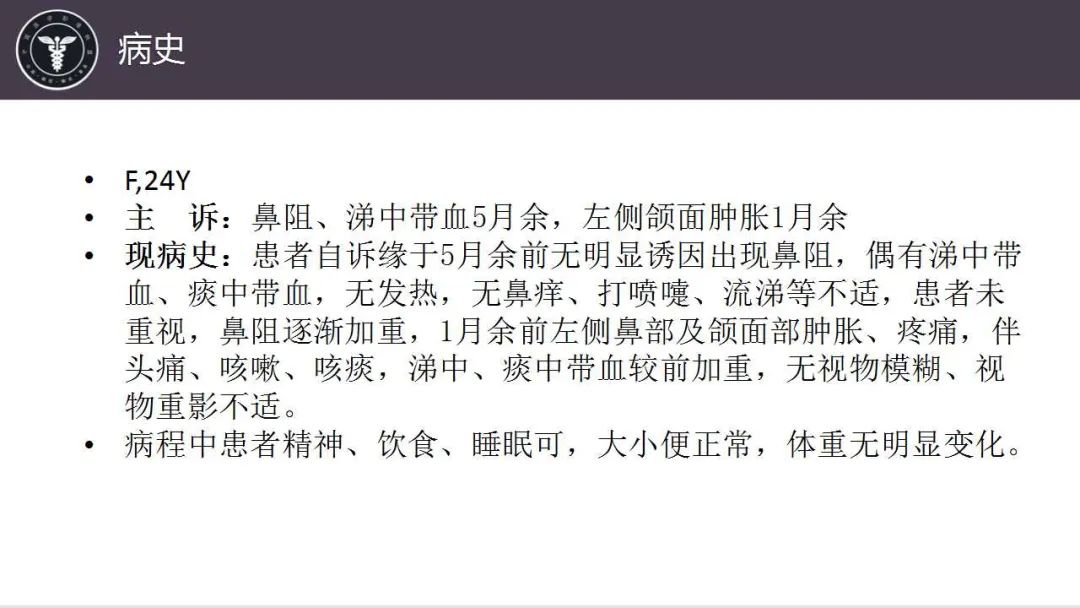 影像PPT - 【病例】鼻腔浆细胞瘤1例CT及MR影像-2