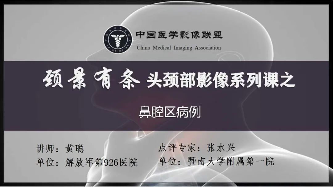 影像PPT - 【病例】鼻腔浆细胞瘤1例CT及MR影像-1