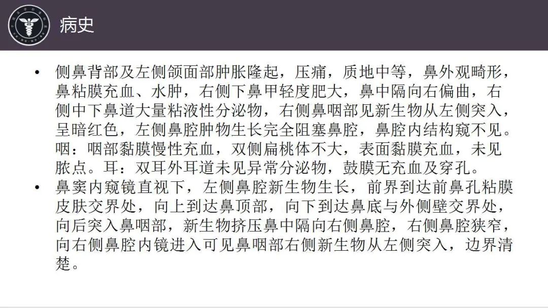影像PPT - 【病例】鼻腔浆细胞瘤1例CT及MR影像-3