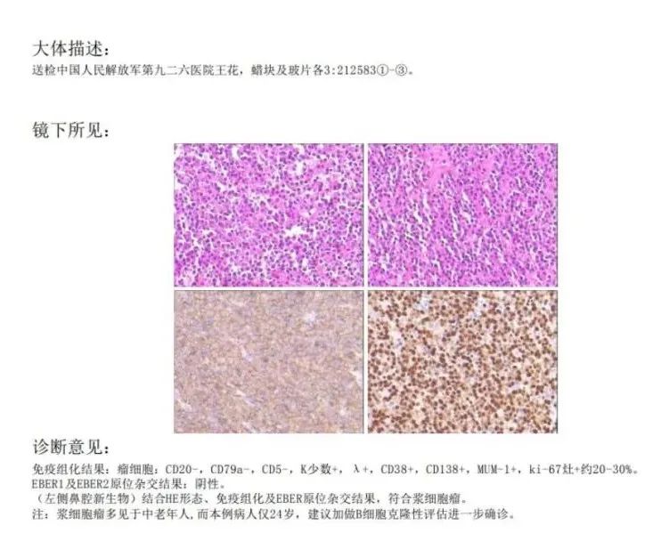 影像PPT - 【病例】鼻腔浆细胞瘤1例CT及MR影像-11