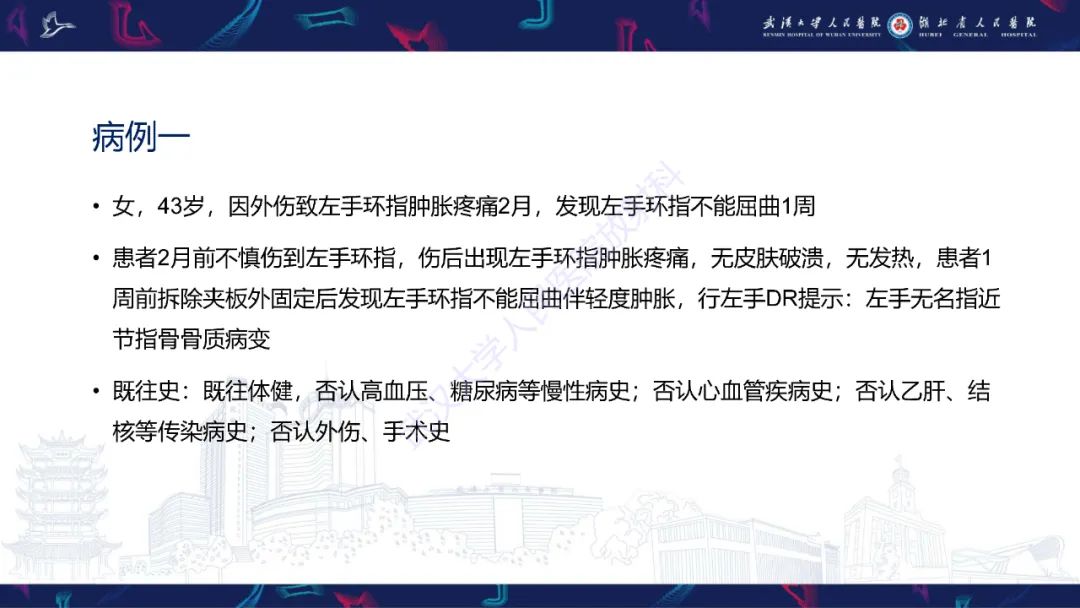 影像PPT - 【PPT】指骨肿瘤影像诊断-2