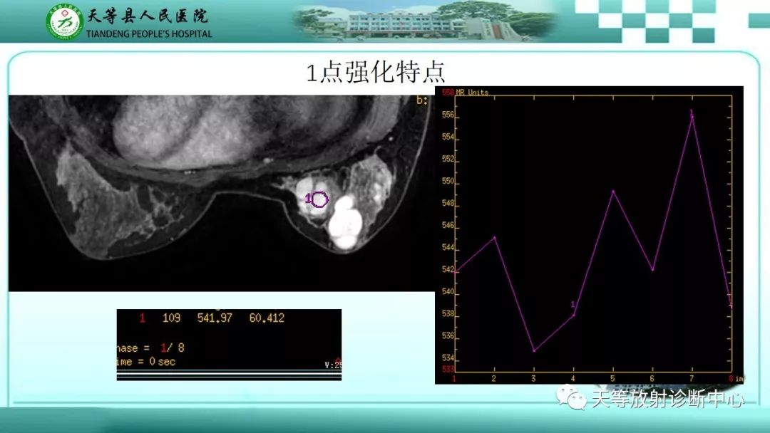 影像PPT - 【病例】乳腺纤维腺瘤1例MR影像-7 影像PPT - 【病例】乳腺纤维腺瘤1例MR影像-7